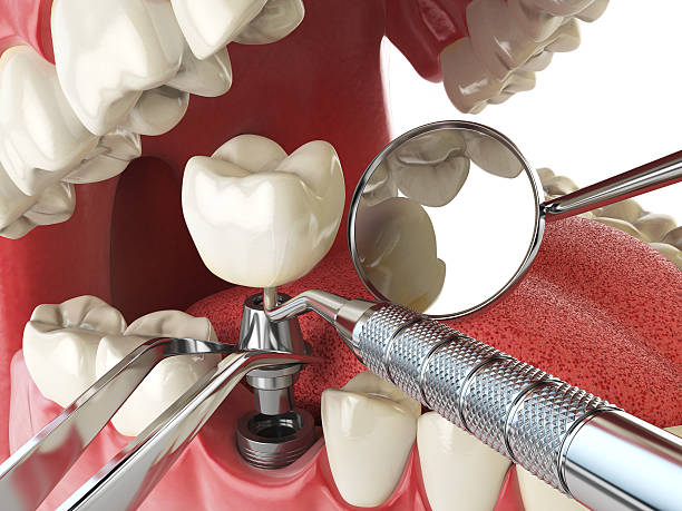 Best Weekend Emergency Dentist in Oglethorpe, GA