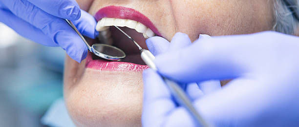 Best Emergency Tooth Extraction in Oglethorpe, GA
